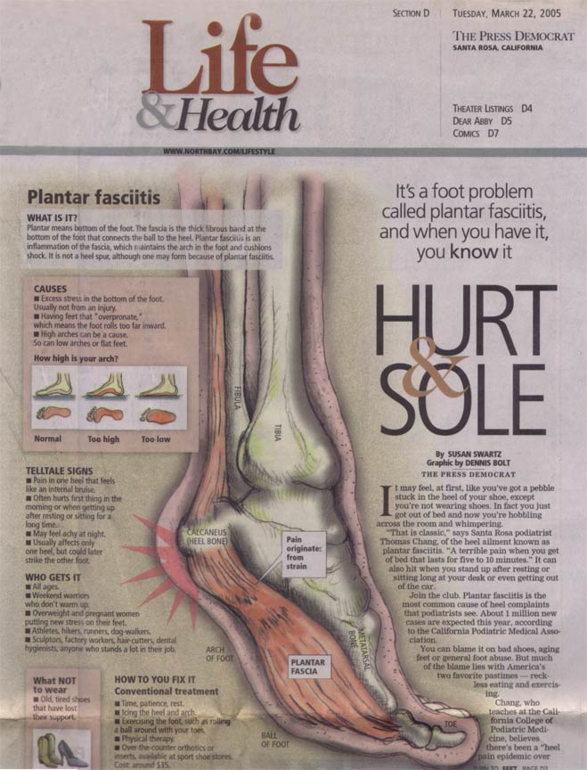 Press Democrat Newspaper Article - Hurt & Sole Article