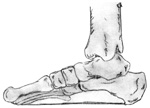 Image-Foot from"Those Aching Feet"